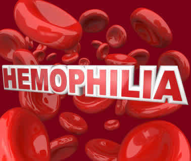 Hemofili